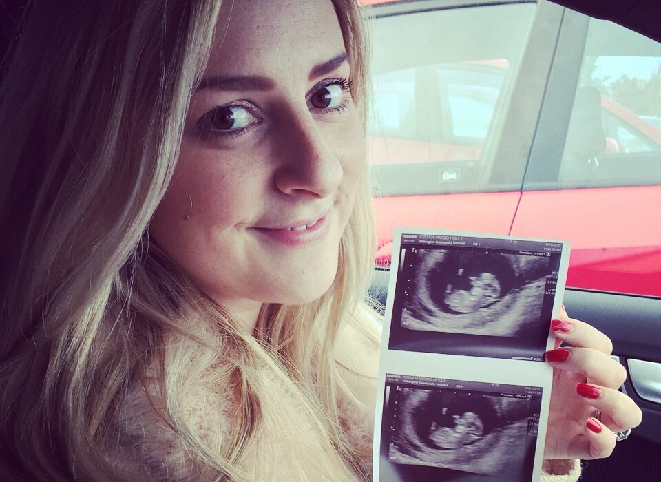 first scan pregnancy