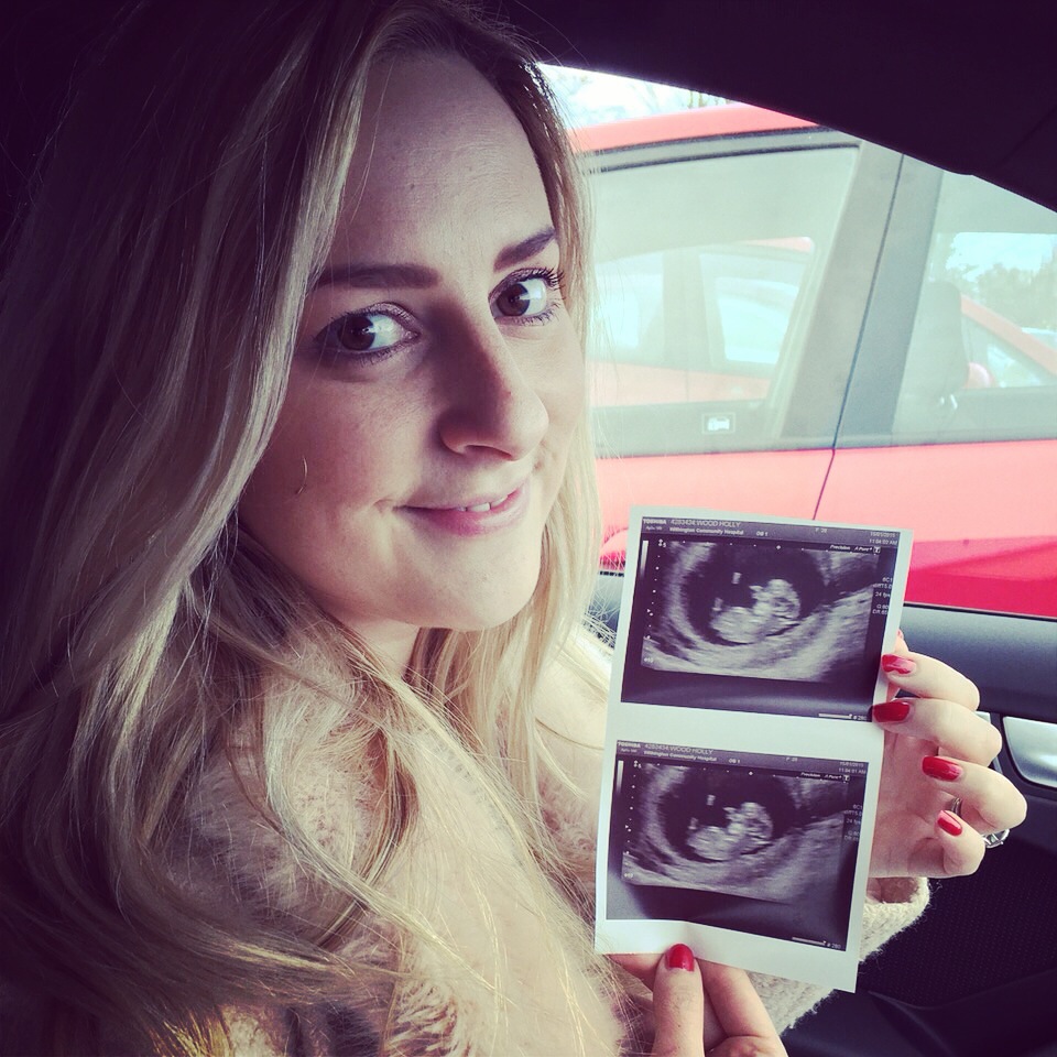The First Scan – My Pregnancy